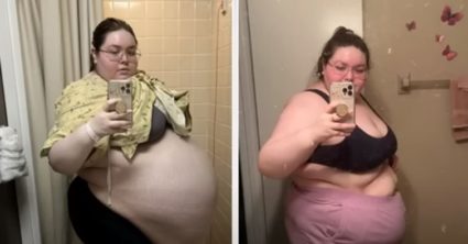 Lekár jej povedal, že je tučná a mala by schudnúť. Žene potom z tela odstránili nádor, ktorý mal takmer 50 kíl